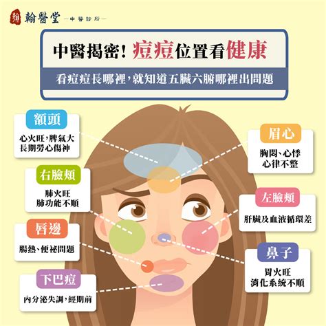 下巴生痘|下巴長痘痘怎麼消？專家揭5原因！6方法改善、不能吃…